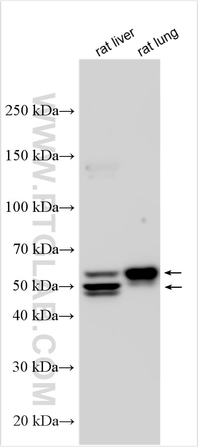 Western Blot (WB) analysis of various lysates using Angiotensinogen/AGT Polyclonal antibody (32895-1-AP)