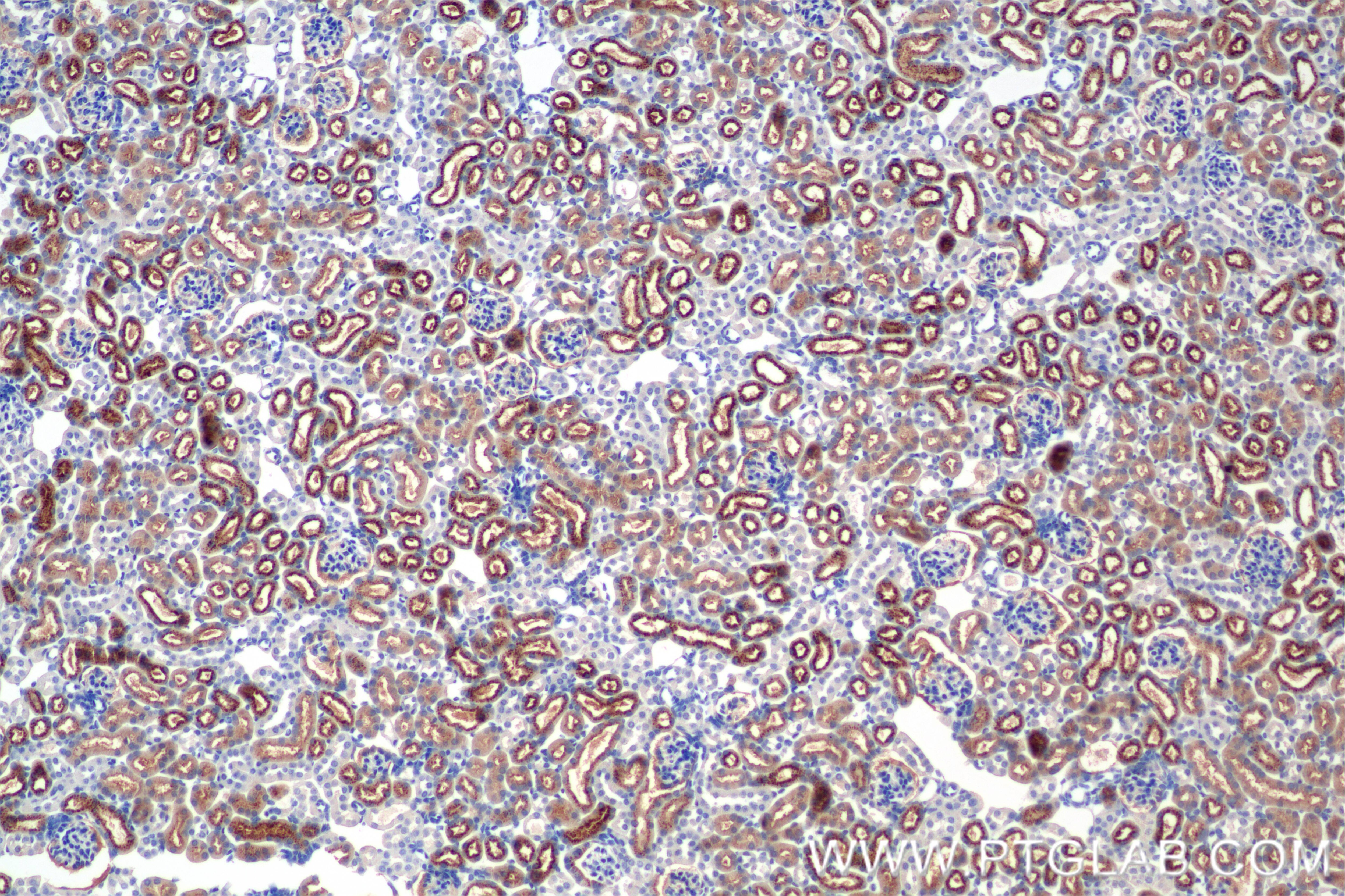 Immunohistochemistry (IHC) staining of mouse kidney tissue using Angiotensinogen/AGT Recombinant monoclonal antibod (86134-1-RR)