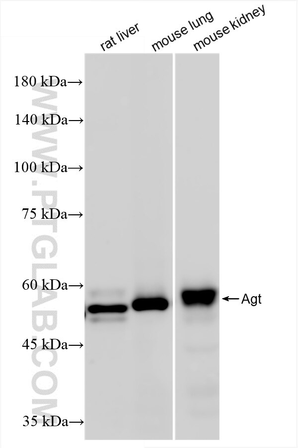 Western Blot (WB) analysis of various lysates using Angiotensinogen/AGT Recombinant antibody (86134-1-RR)