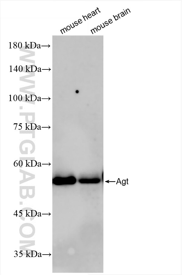 Western Blot (WB) analysis of various lysates using Angiotensinogen/AGT Recombinant antibody (86134-1-RR)