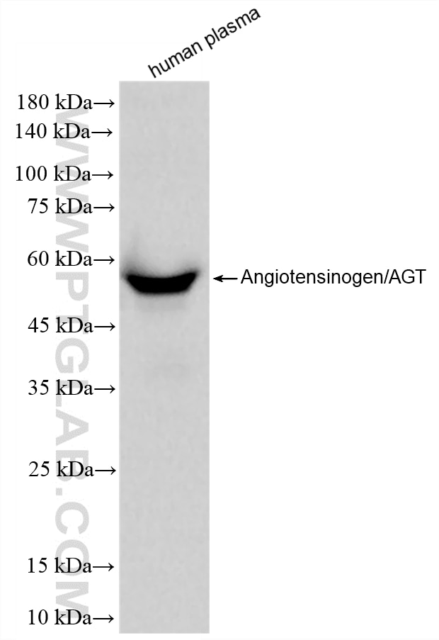 human plasma were subjected to SDS PAGE followed by western blot with 86729-1-RR (Angiotensinogen/AGT antibody) at dilution of 1:10000 incubated at room temperature for 1.5 hours. This data was developed using the same antibody clone with 86729-1-PBS in a different storage buffer formulation. Western Blot (WB) analysis of human plasma using Angiotensinogen/AGT Recombinant monoclonal antibod (86729-1-RR)