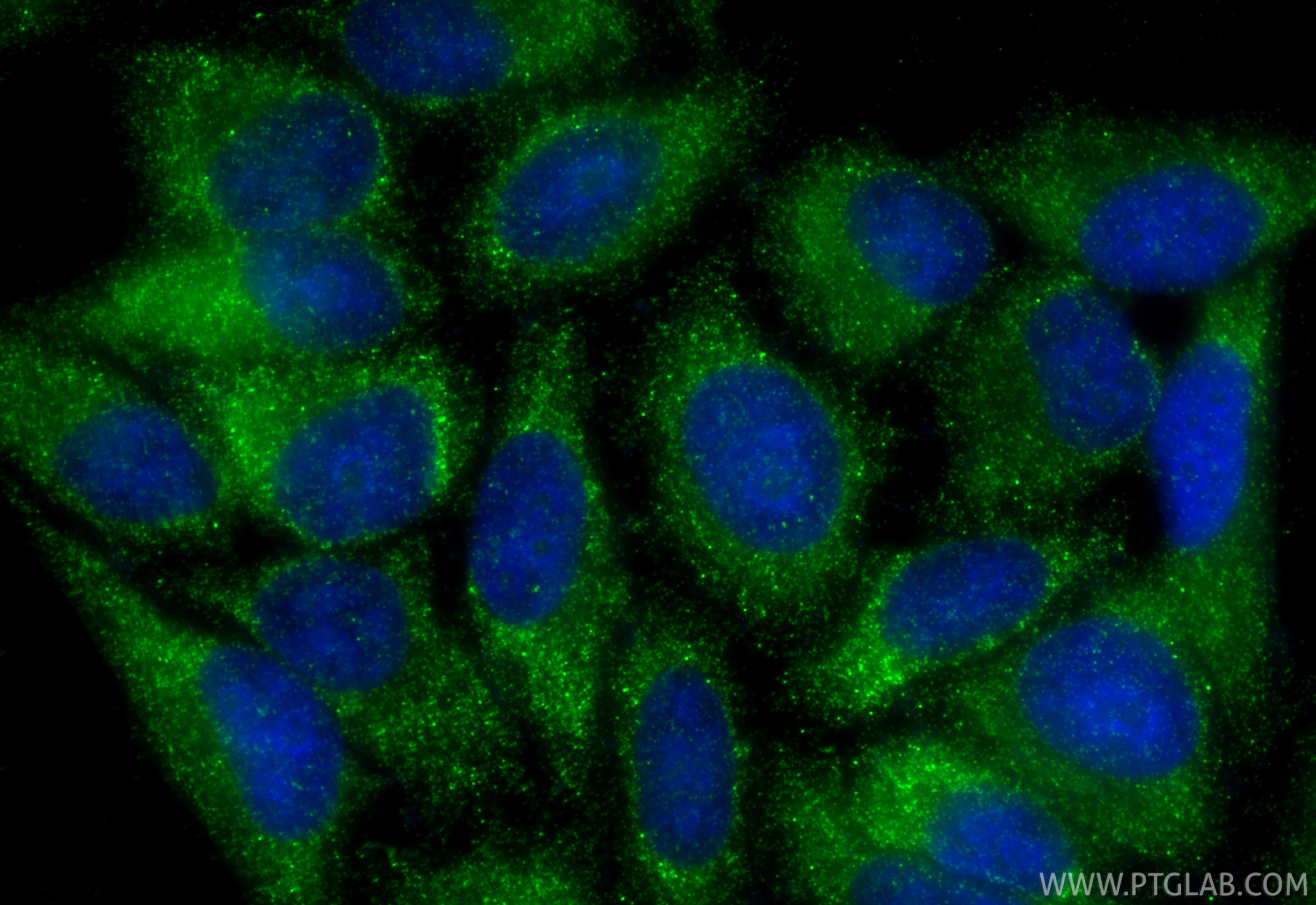 Immunofluorescence (IF) / fluorescent staining of HepG2 cells using Multi-rAb® Angiotensinogen/AGT Multi-Recombinant a (RMX00082)