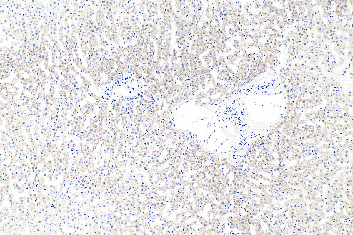 Immunohistochemistry (IHC) staining of human liver tissue using Multi-rAb® Angiotensinogen/AGT Multi-Recombinant a (RMX00082)