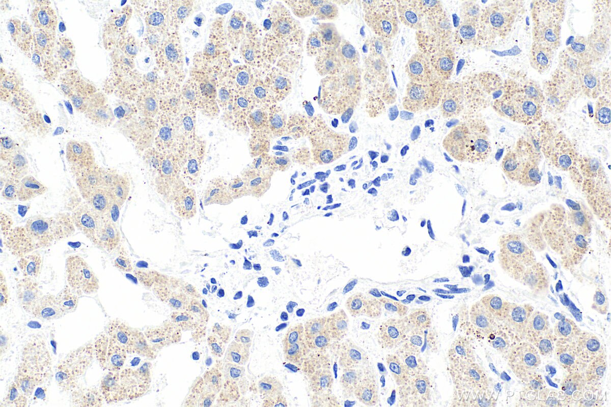 Immunohistochemistry (IHC) staining of human liver tissue using Multi-rAb® Angiotensinogen/AGT Multi-Recombinant a (RMX00082)