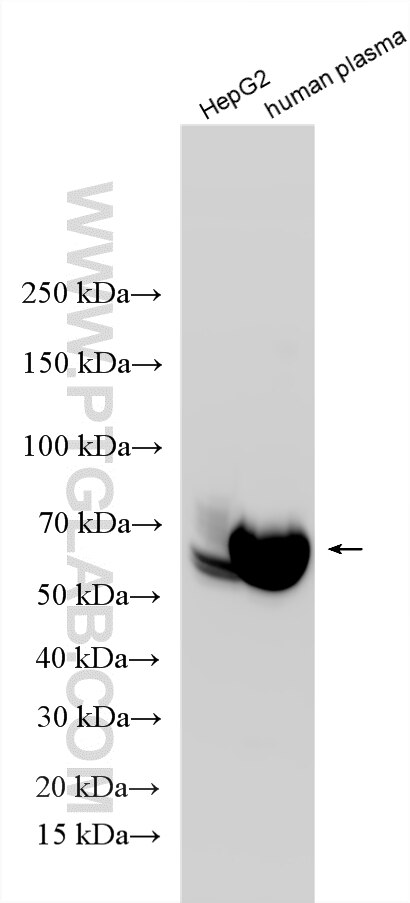 Western Blot (WB) analysis of various lysates using Multi-rAb® Angiotensinogen/AGT Multi-Recombinant a (RMX00082)