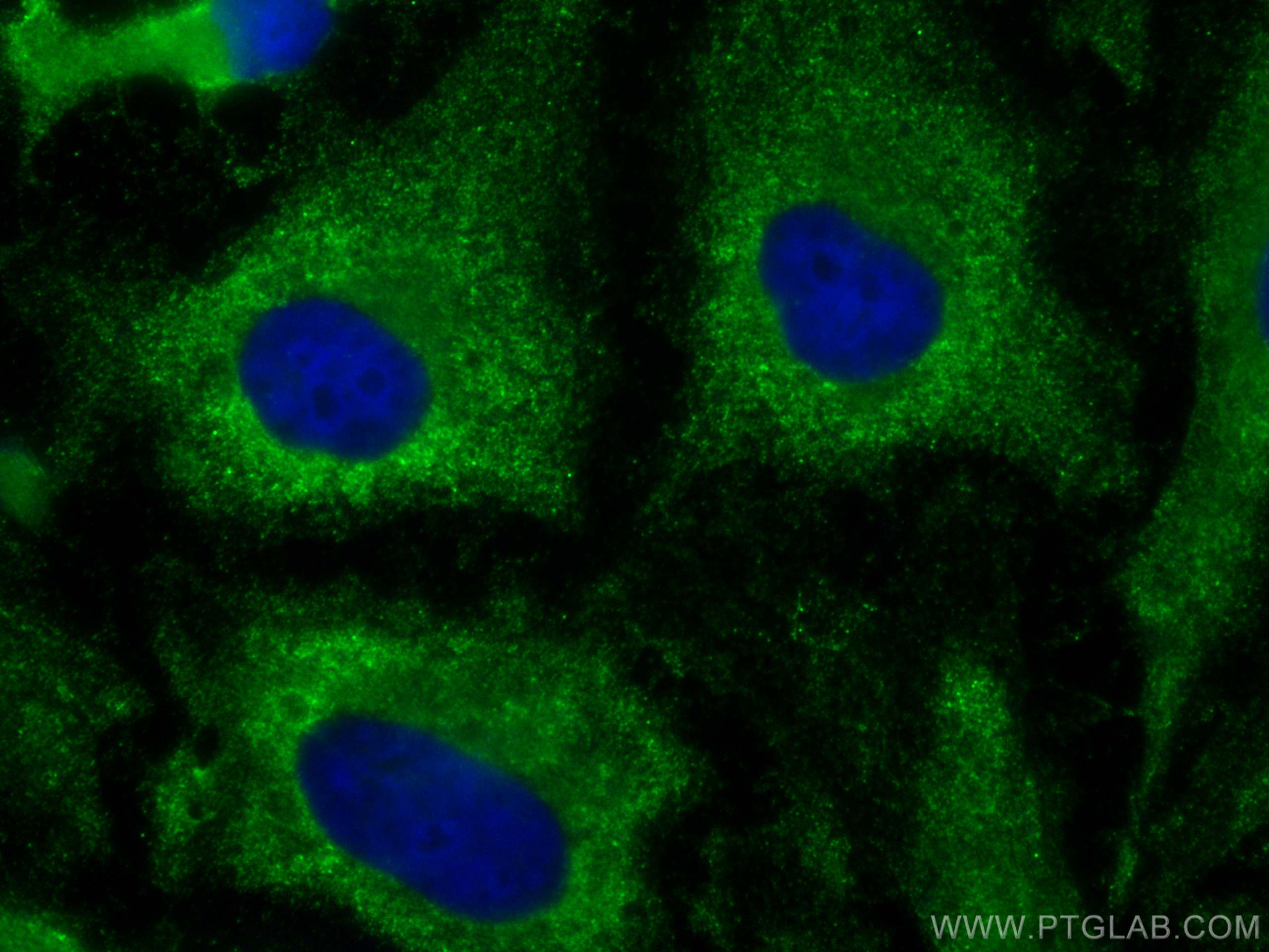 Immunofluorescence (IF) / fluorescent staining of HeLa cells using CoraLite® Plus 488-conjugated Angiotensinogen Poly (CL488-23972)