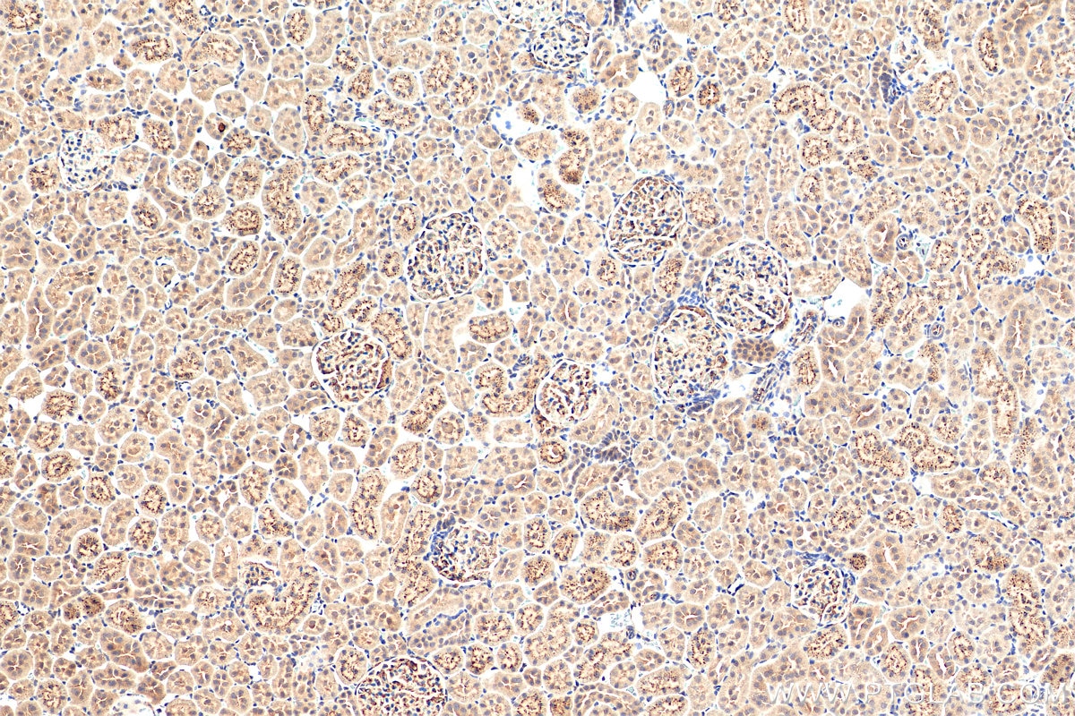 Immunohistochemistry (IHC) staining of rat kidney tissue using Angptl4 Polyclonal antibody (51109-1-AP)