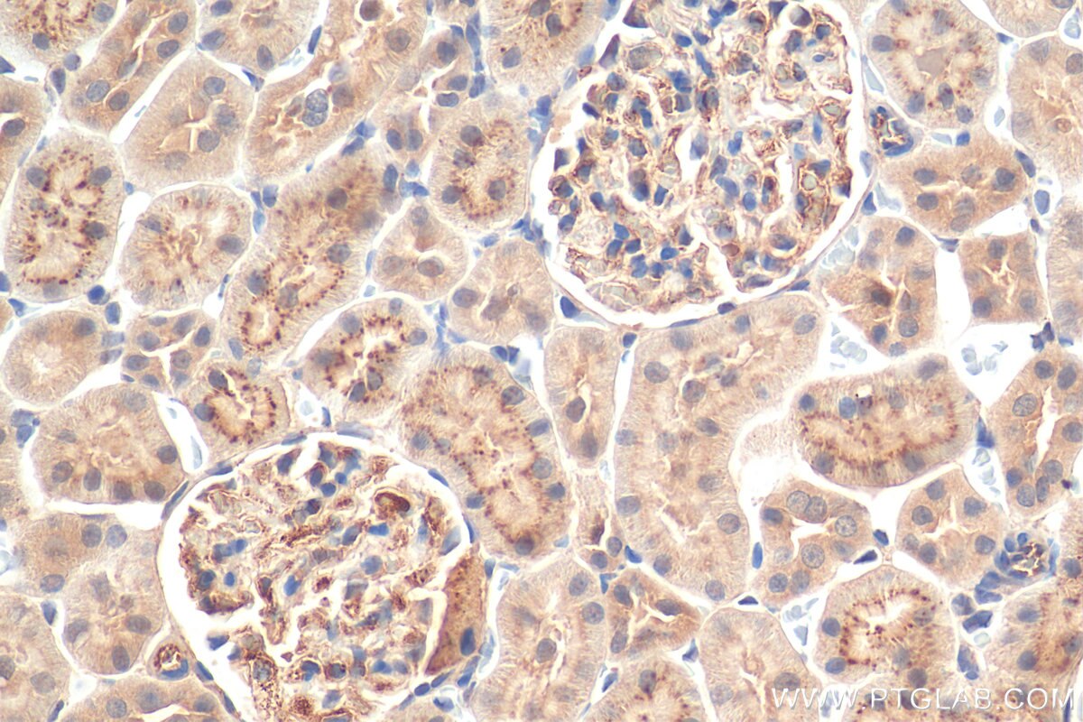 Immunohistochemistry (IHC) staining of rat kidney tissue using Angptl4 Polyclonal antibody (51109-1-AP)
