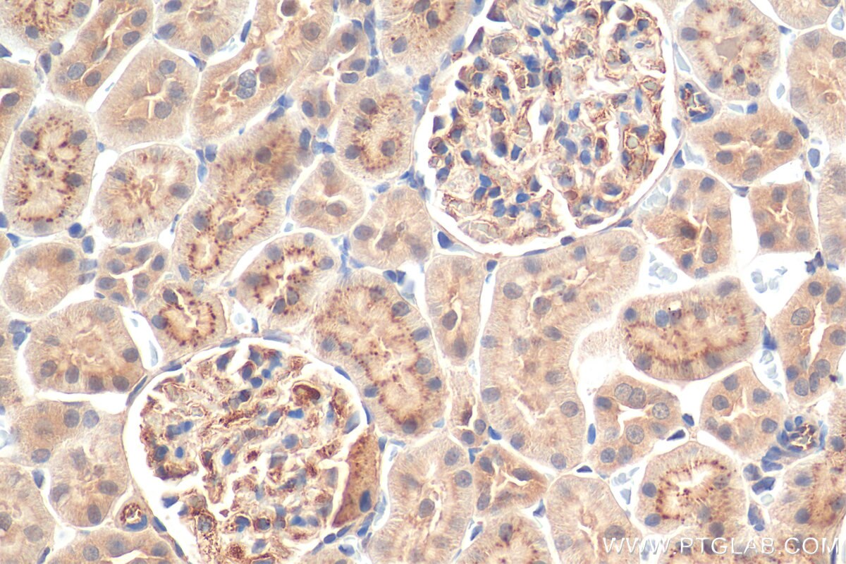 IHC staining of rat kidney using 51109-1-AP