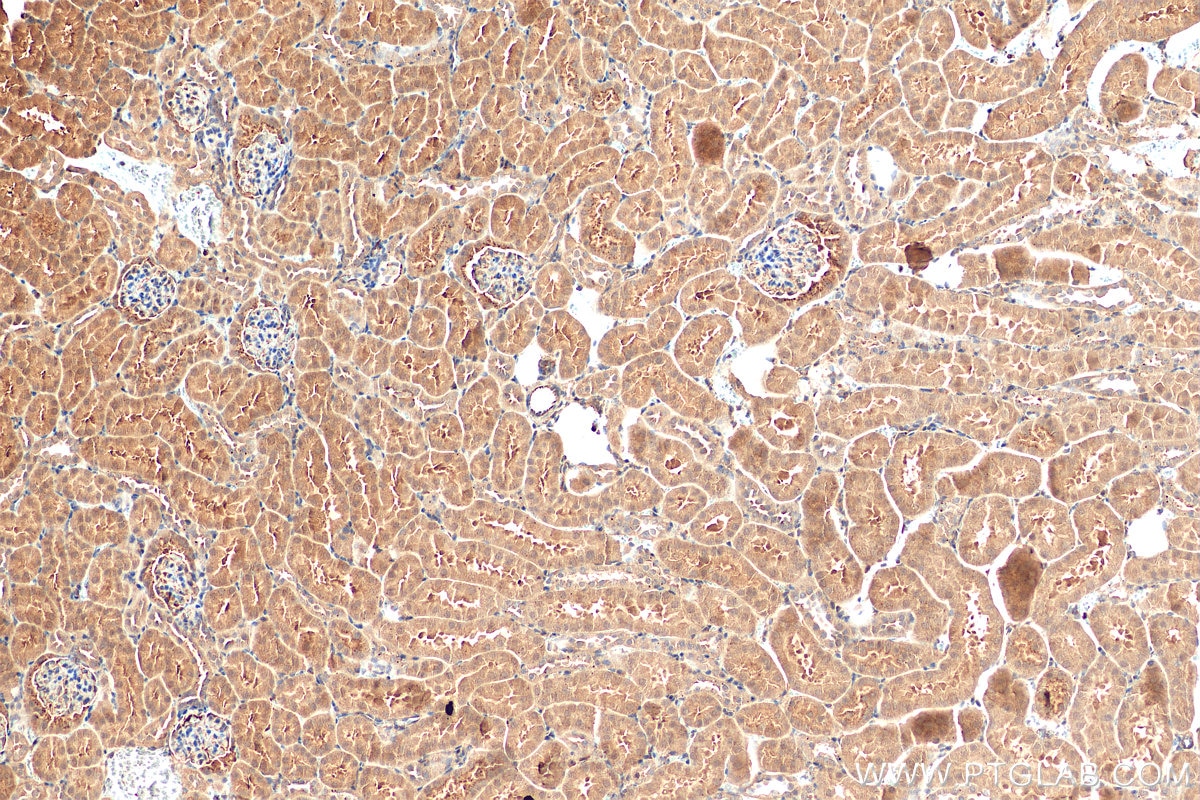 Immunohistochemistry (IHC) staining of mouse kidney tissue using Angptl4 Polyclonal antibody (51109-1-AP)