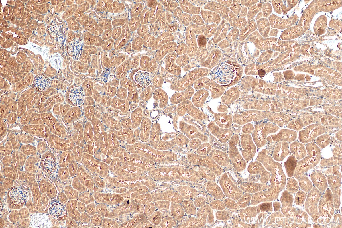 IHC staining of mouse kidney using 51109-1-AP