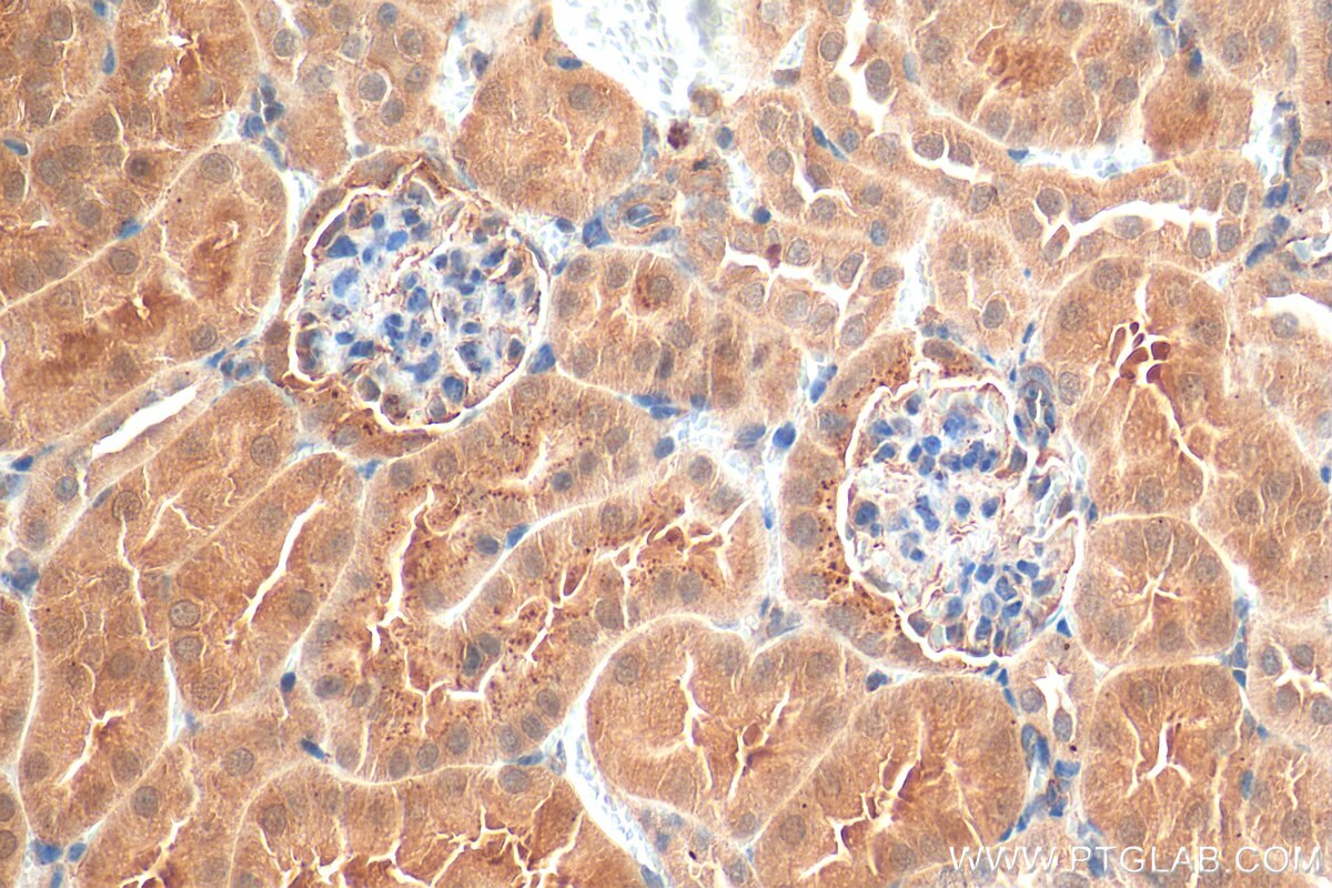 IHC staining of mouse kidney using 51109-1-AP
