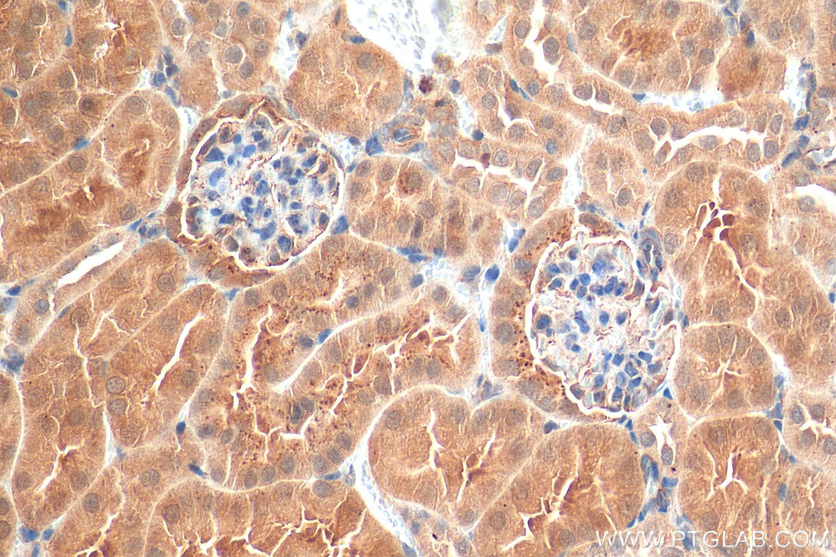 Immunohistochemistry (IHC) staining of mouse kidney tissue using Angptl4 Polyclonal antibody (51109-1-AP)