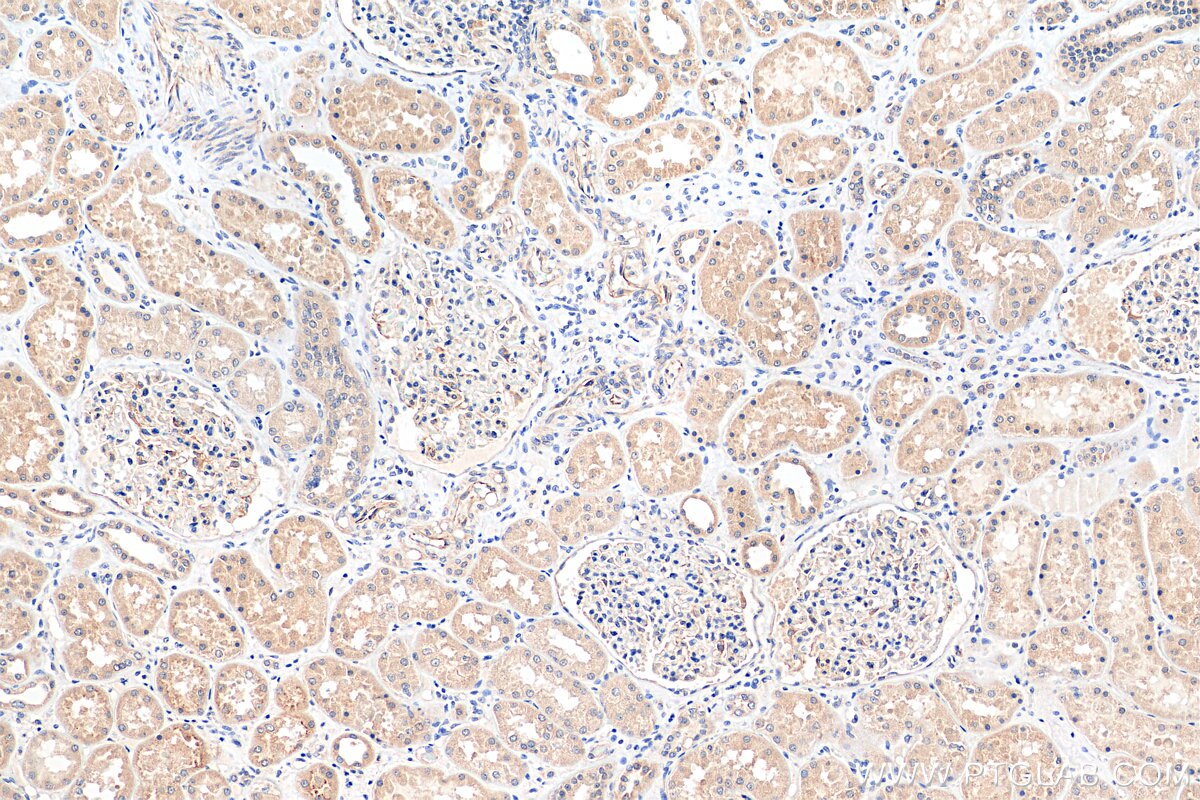 Immunohistochemistry (IHC) staining of human kidney tissue using Angptl4 Polyclonal antibody (51109-1-AP)