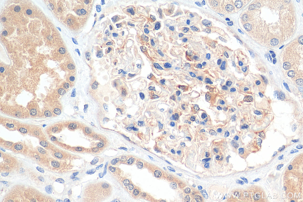 Immunohistochemistry (IHC) staining of human kidney tissue using Angptl4 Polyclonal antibody (51109-1-AP)
