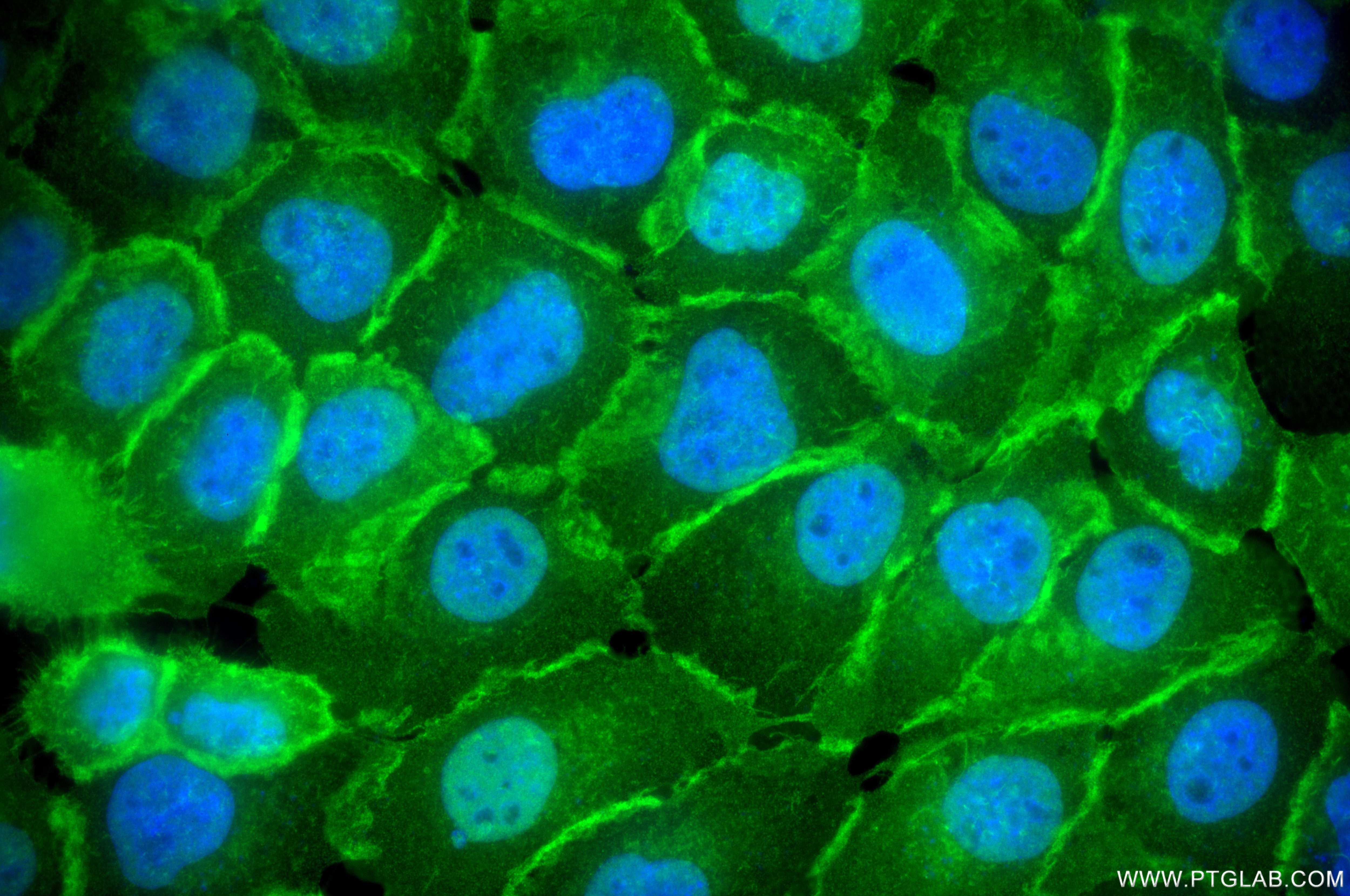 IF Staining of A431 using 87316-3-RR Immunofluorescence (IF) / fluorescent staining of A431 cells using Annexin A1 Recombinant monoclonal antibody (87316-3-RR)