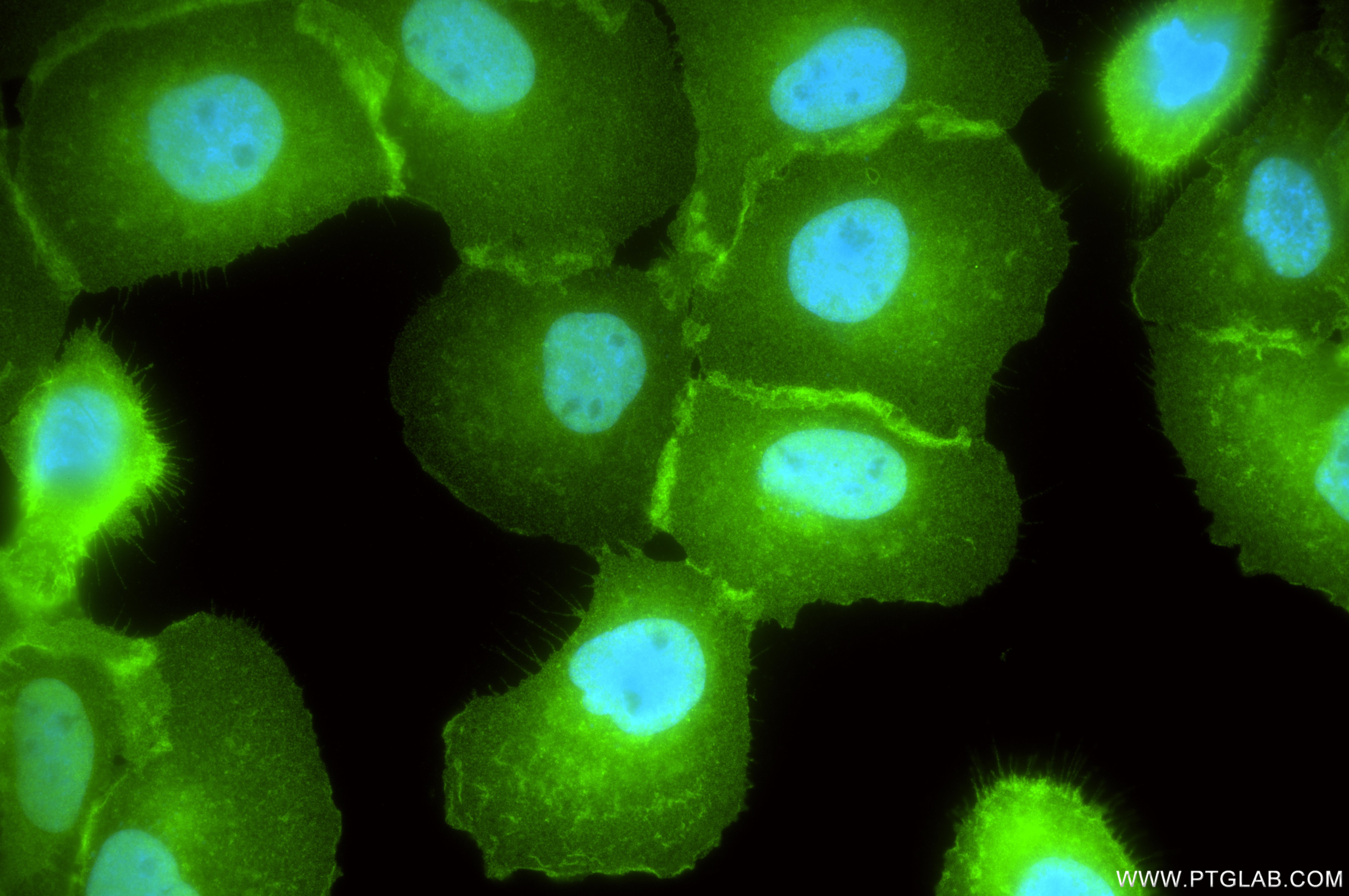 IF Staining of A431 using 87316-3-RR Immunofluorescence (IF) / fluorescent staining of A431 cells using Annexin A1 Recombinant monoclonal antibody (87316-3-RR)