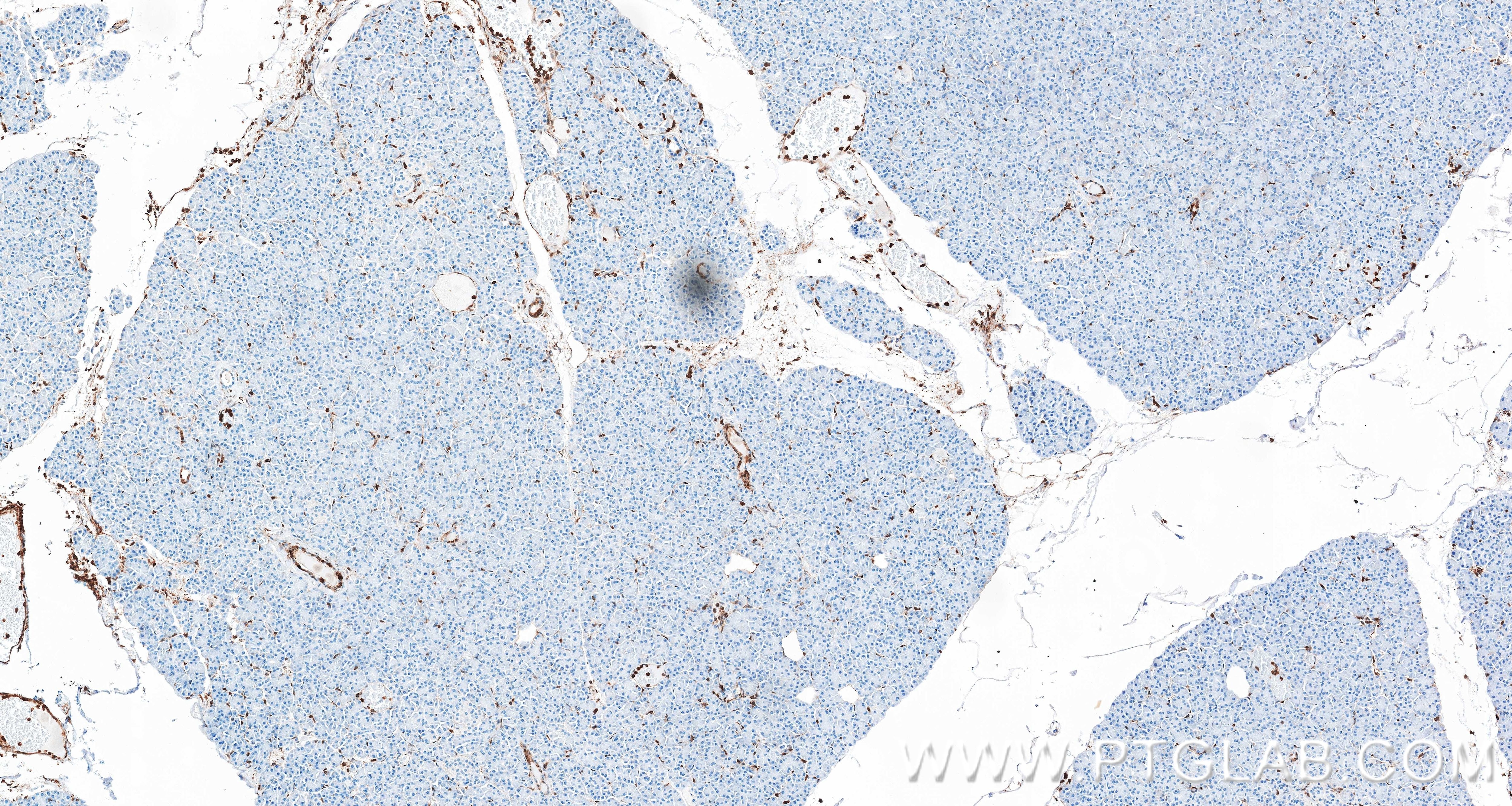 IHC staining of human pancreas using 87316-3-RR Immunohistochemistry (IHC) staining of human pancreas tissue using Annexin A1 Recombinant monoclonal antibody (87316-3-RR)