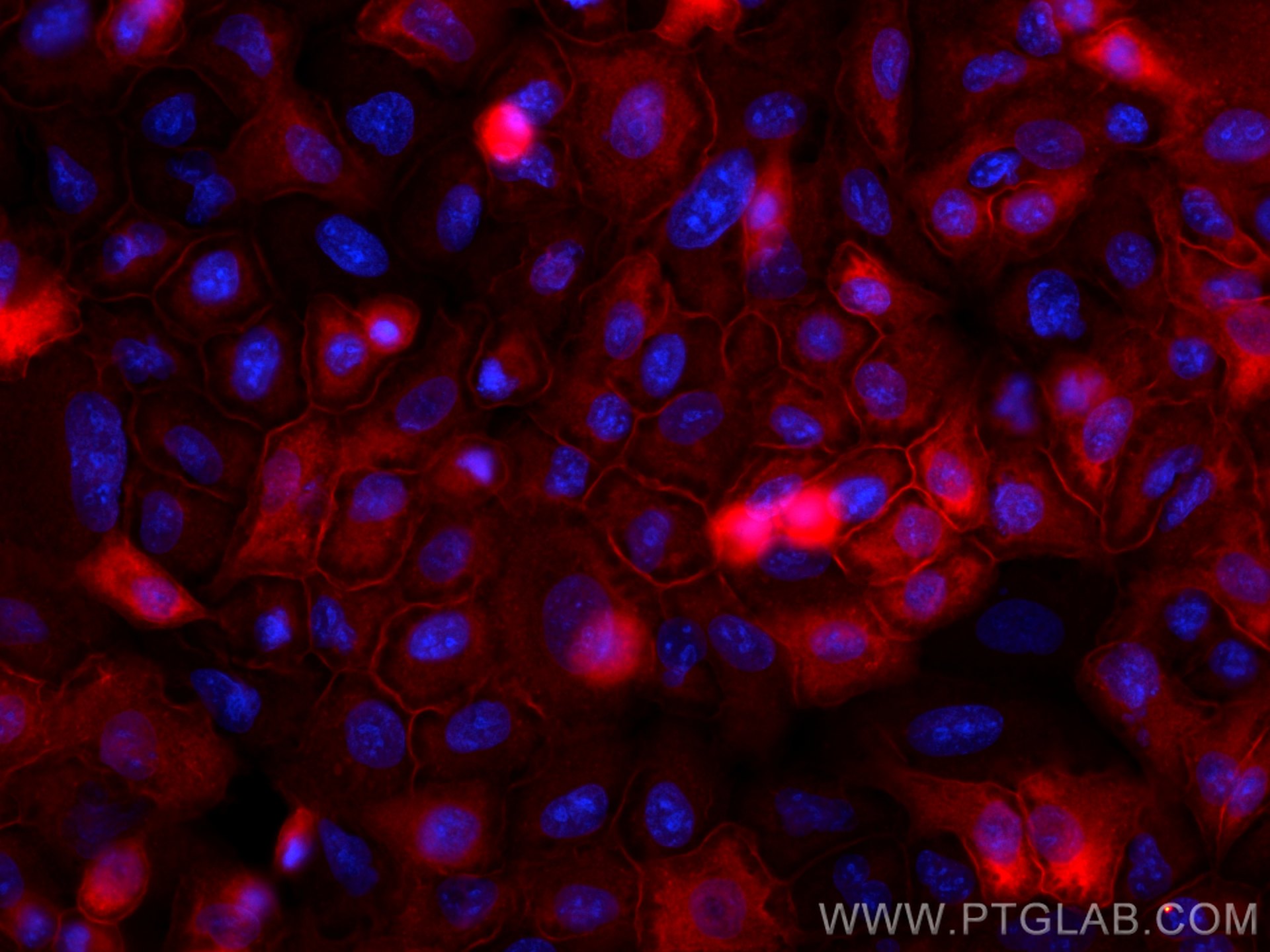 Immunofluorescence (IF) / fluorescent staining of A549 cells using CoraLite®594-conjugated Annexin A1 Monoclonal anti (CL594-66344)