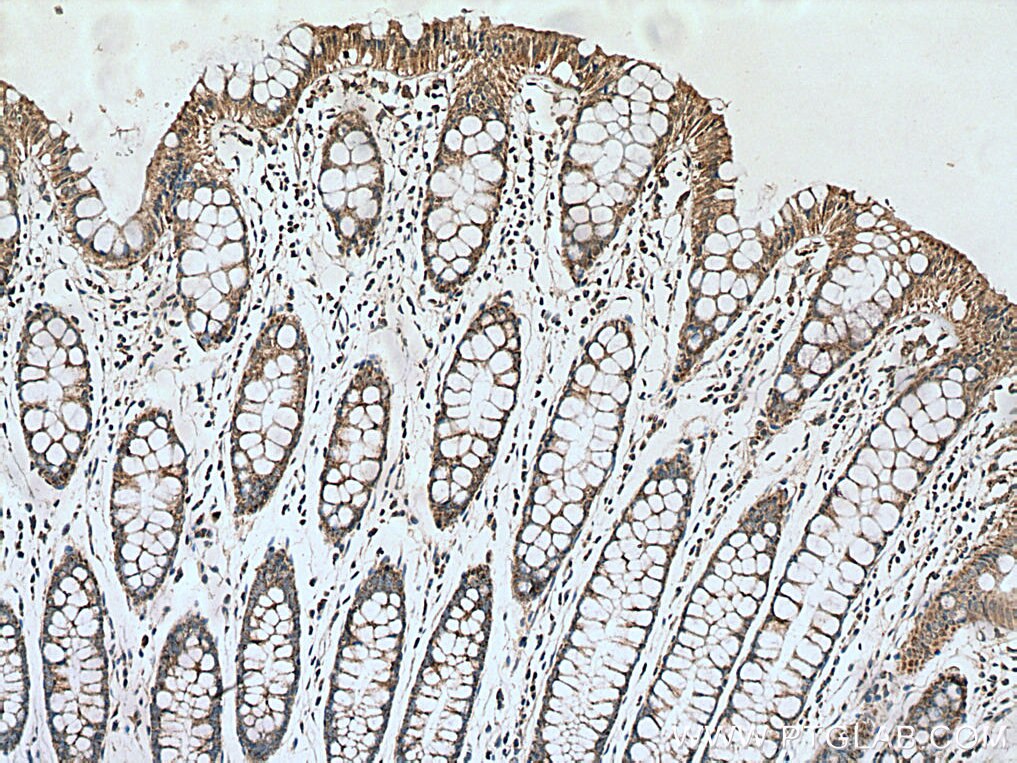 Immunohistochemistry (IHC) staining of human colon tissue using Annexin A10 Monoclonal antibody (66869-1-Ig)