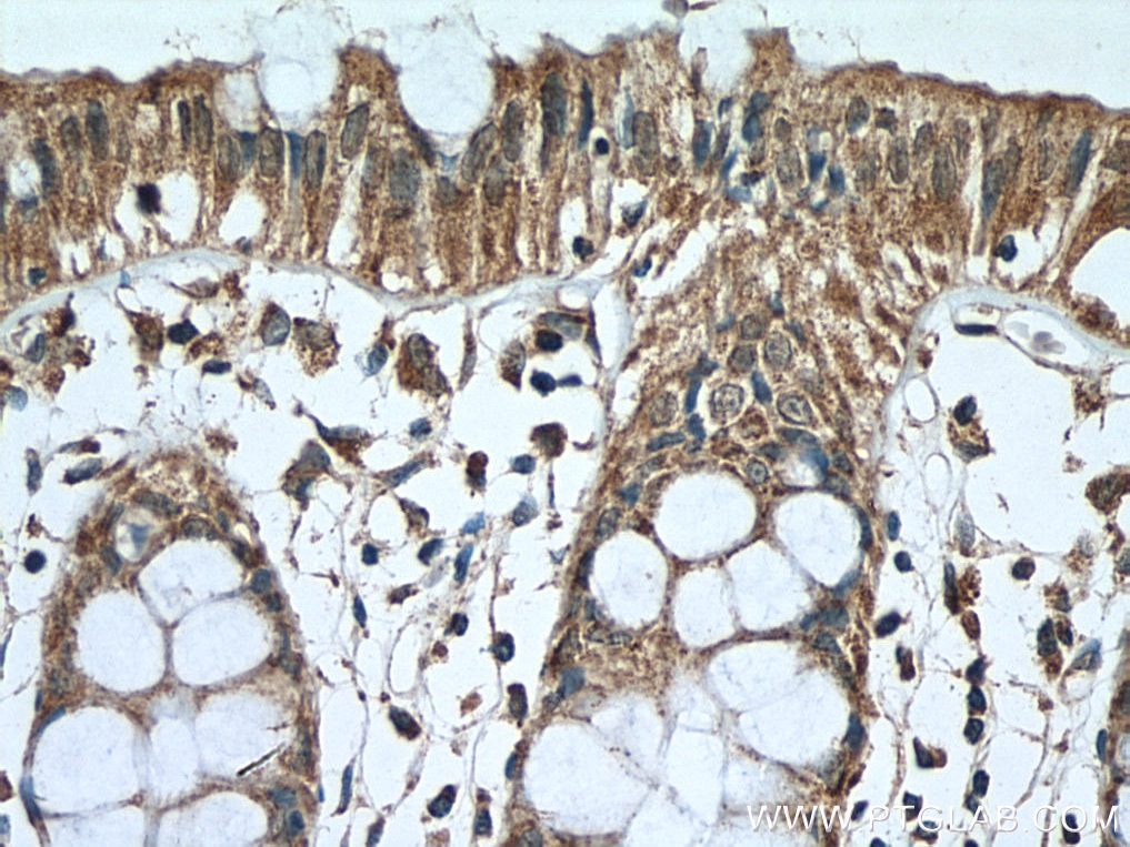 Immunohistochemistry (IHC) staining of human colon tissue using Annexin A10 Monoclonal antibody (66869-1-Ig)