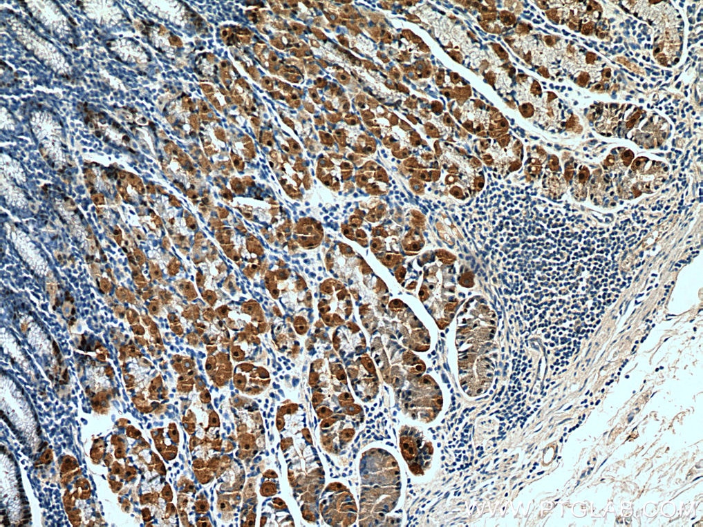 Immunohistochemistry (IHC) staining of human stomach tissue using Annexin A10 Monoclonal antibody (66869-1-Ig)
