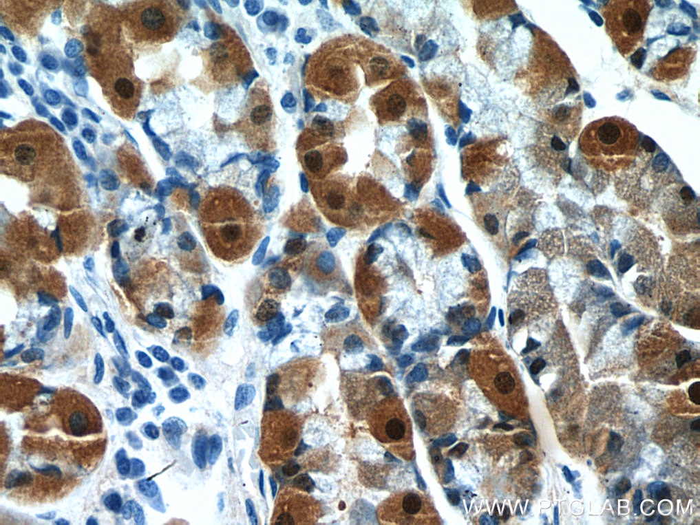 Immunohistochemistry (IHC) staining of human stomach tissue using Annexin A10 Monoclonal antibody (66869-1-Ig)