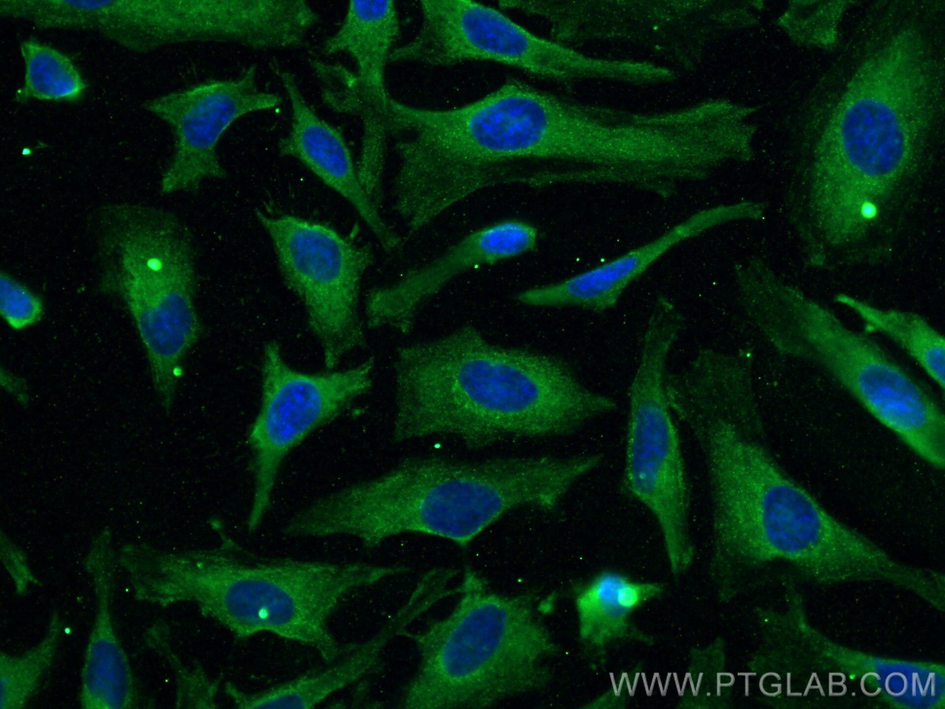 Immunofluorescence (IF) / fluorescent staining of HeLa cells using Annexin A11 Monoclonal antibody (68089-1-Ig)