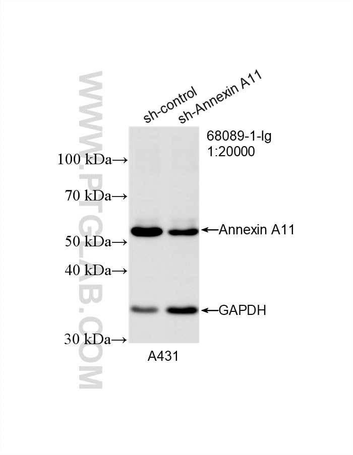 WB result of Annexin A11 antibody (68089-1-Ig; 1:20000; incubated at room temperature for 1.5 hours) with sh-Control and sh-Annexin A11 transfected A431 cells. Western Blot (WB) analysis of A431 cells using Annexin A11 Monoclonal antibody (68089-1-Ig)