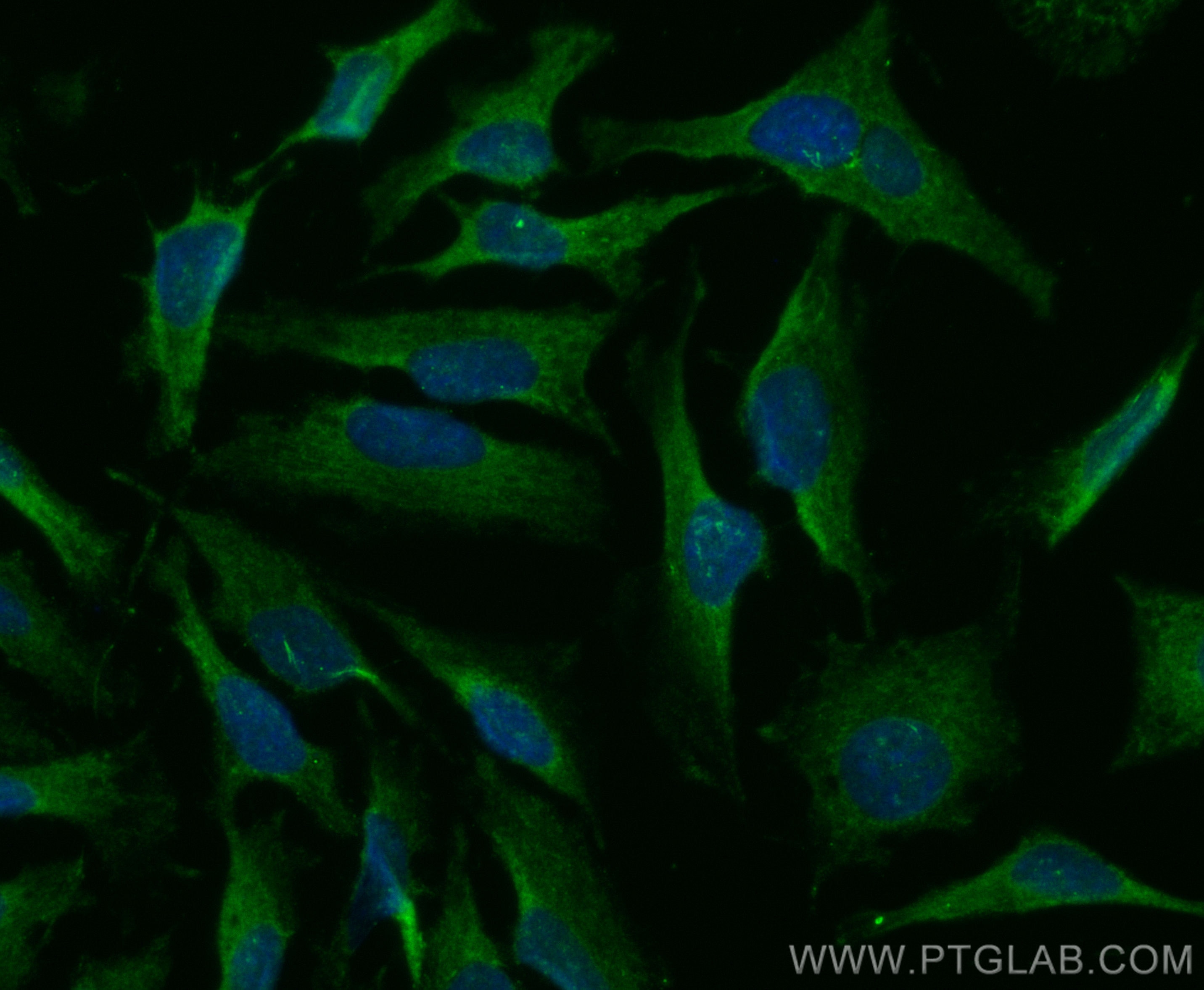 Immunofluorescence (IF) / fluorescent staining of HeLa cells using CoraLite® Plus 488-conjugated Annexin A11 Polyclon (CL488-10479)