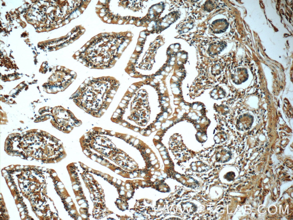 Immunohistochemistry (IHC) staining of human small intestine tissue using Annexin A13 Polyclonal antibody (25153-1-AP)