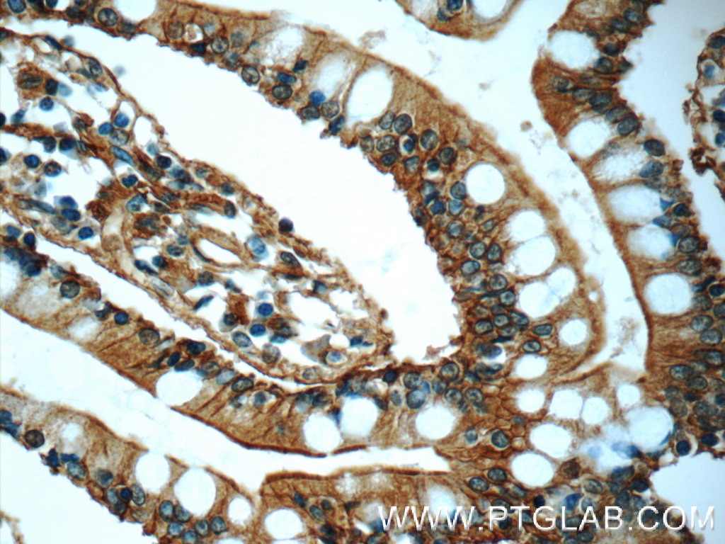 Immunohistochemistry (IHC) staining of human small intestine tissue using Annexin A13 Polyclonal antibody (25153-1-AP)