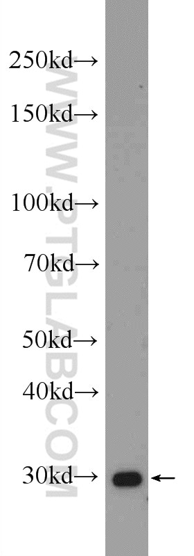 WB analysis of mouse small intestine using 25153-1-AP