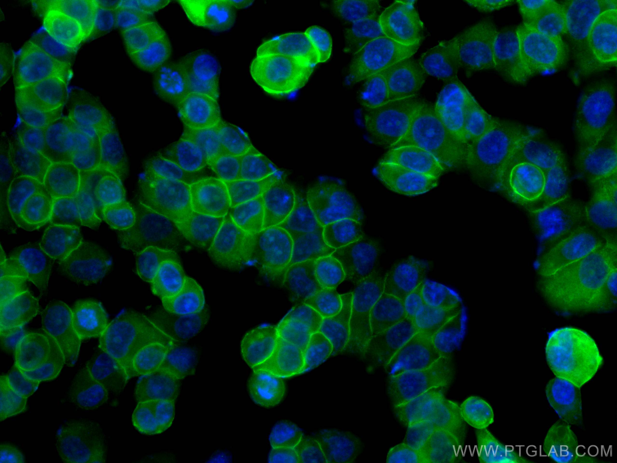 Immunofluorescence (IF) / fluorescent staining of T-47D cells using CoraLite® Plus 488-conjugated Annexin A2 Monoclona (CL488-66035)