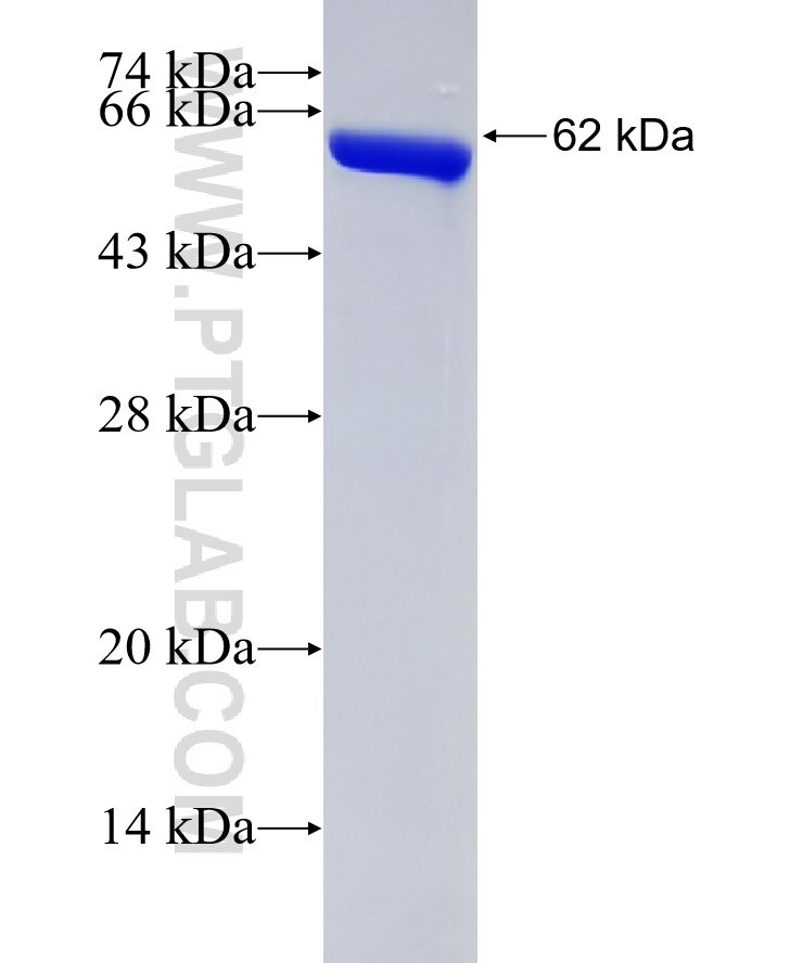 Annexin A2 fusion protein Ag1777 SDS-PAGE