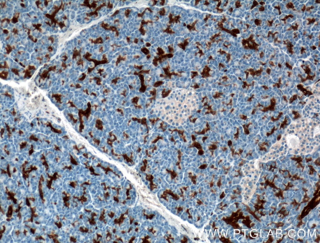 IHC staining of human pancreas using 66405-1-Ig