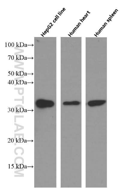 Western Blot (WB) analysis of various lysates using Annexin A3 Monoclonal antibody (66405-1-Ig)