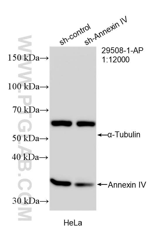 WB analysis of HeLa using 29508-1-AP Western Blot (WB) analysis of HeLa cells using Annexin A4 Polyclonal antibody (29508-1-AP)