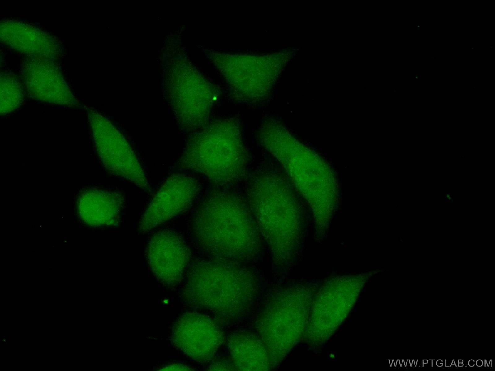 IF Staining of HeLa using 60288-2-Ig