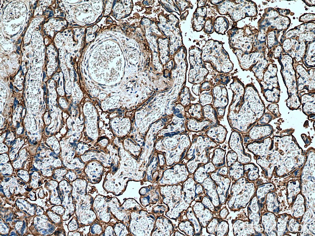 IHC staining of human placenta using 60288-2-Ig