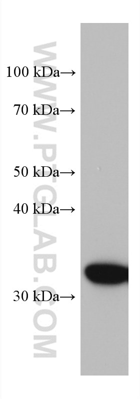 Western Blot (WB) analysis of human placenta tissue using Annexin A4 Monoclonal antibody (60288-2-Ig)