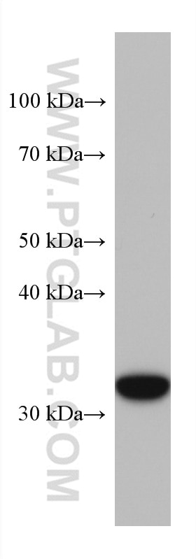 WB analysis of COLO 320 using 60288-2-Ig