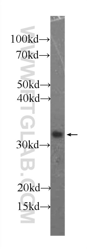 Western Blot (WB) analysis of human heart tissue using Annexin A4 Monoclonal antibody (60288-2-Ig)