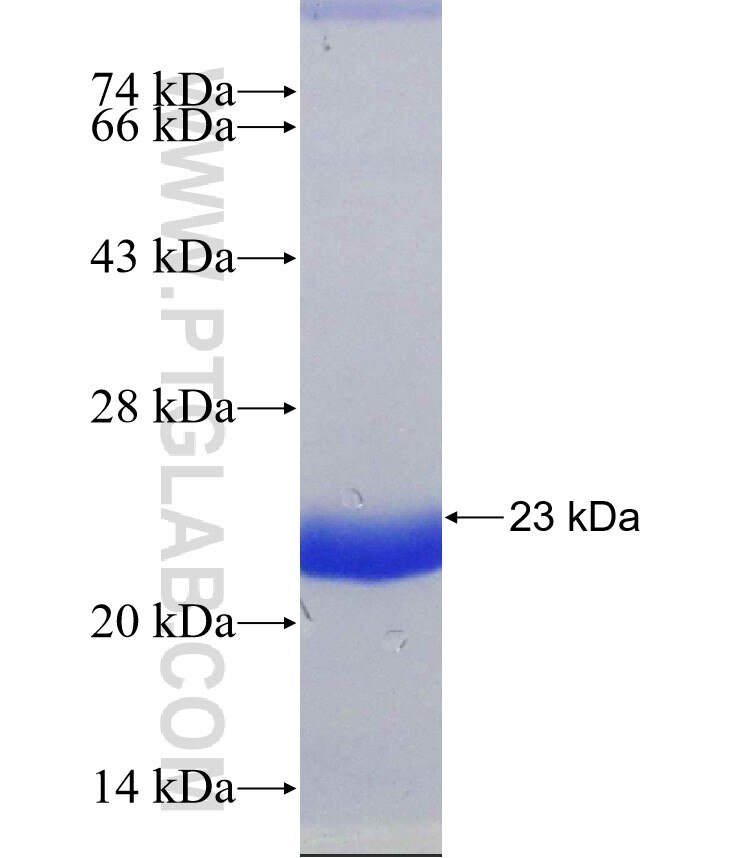 Annexin IV fusion protein Ag30827 SDS-PAGE