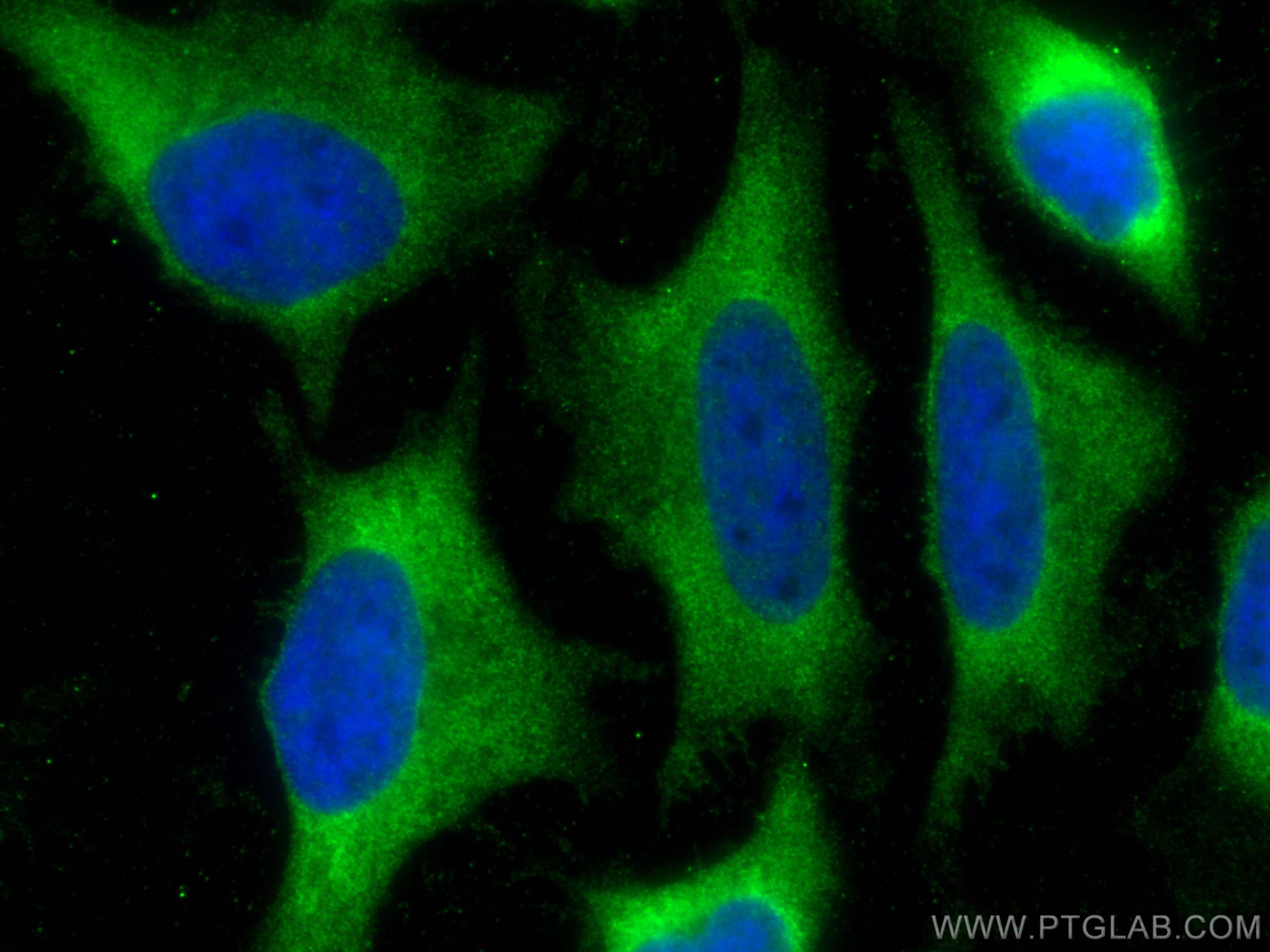 Immunofluorescence (IF) / fluorescent staining of HeLa cells using Annexin V Monoclonal antibody (66245-1-Ig)
