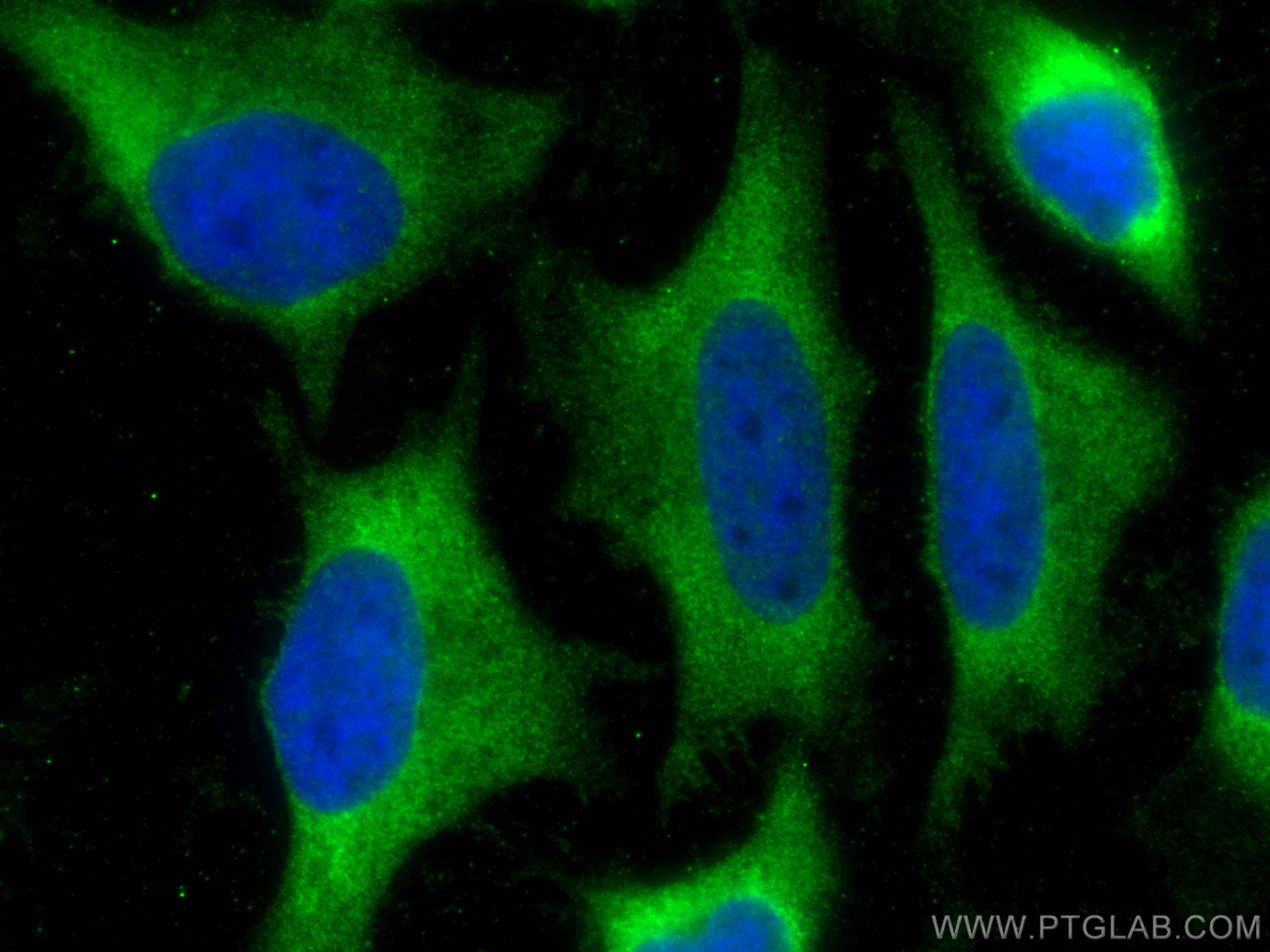 IF Staining of HeLa using 66245-1-Ig