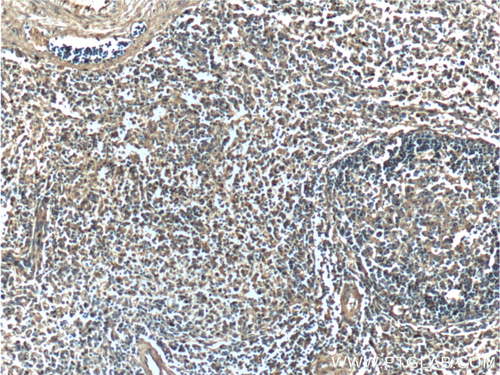 IHC staining of human spleen using 66245-1-Ig