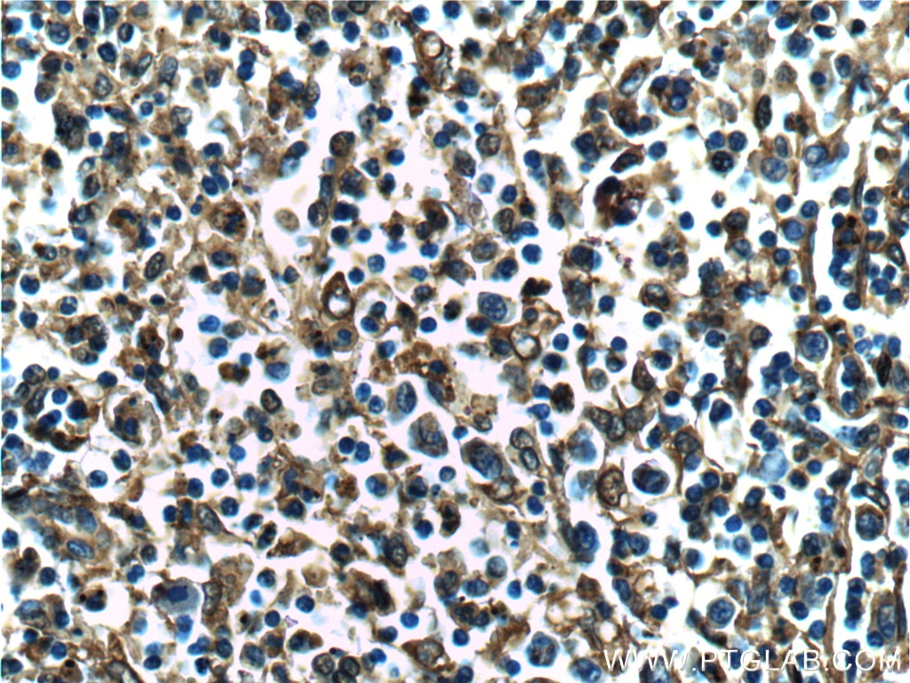 Immunohistochemistry (IHC) staining of human spleen tissue using Annexin V Monoclonal antibody (66245-1-Ig)
