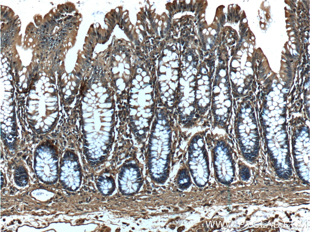 Immunohistochemistry (IHC) staining of human colon tissue using Annexin V Monoclonal antibody (66245-1-Ig)