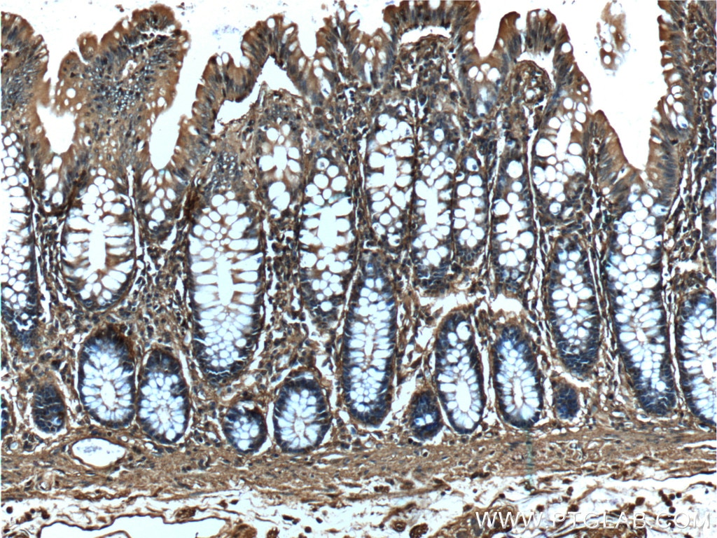 IHC staining of human colon using 66245-1-Ig